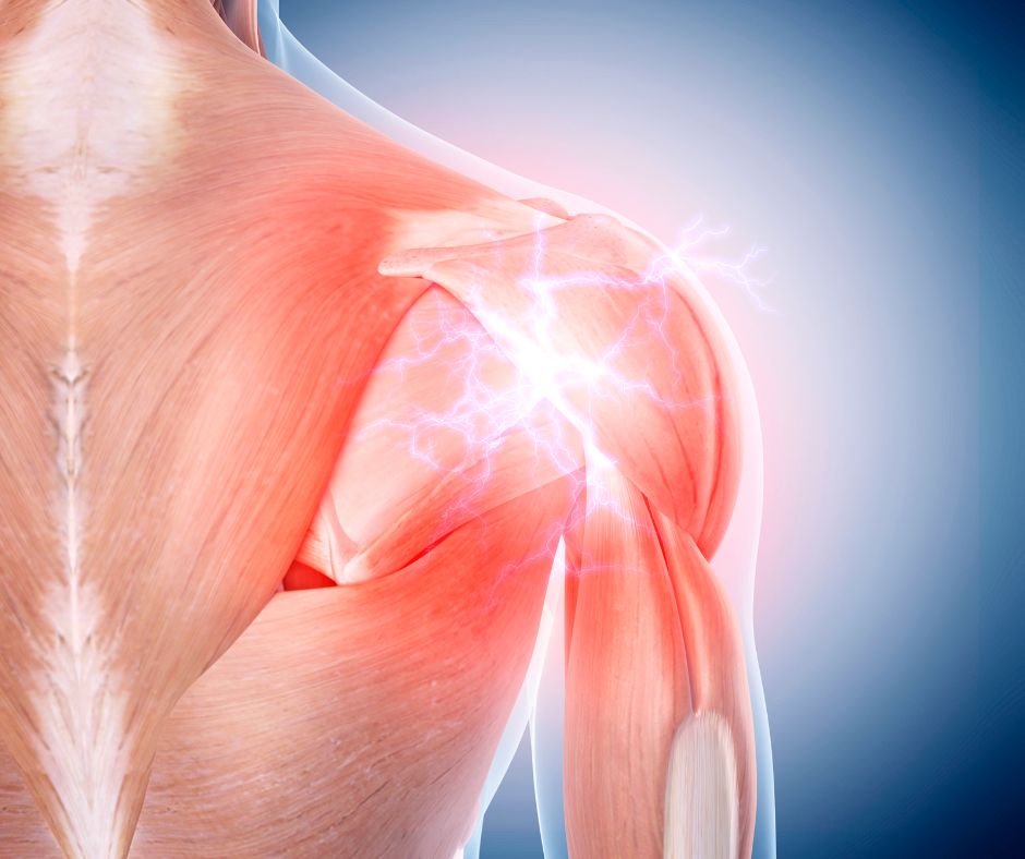 How Posture Therapy Eliminates Shoulder Pain: The Problem Isn’t in Your Shoulder